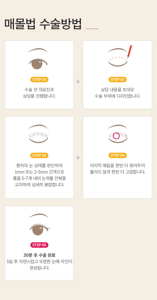 �ֲ�Ǯ����