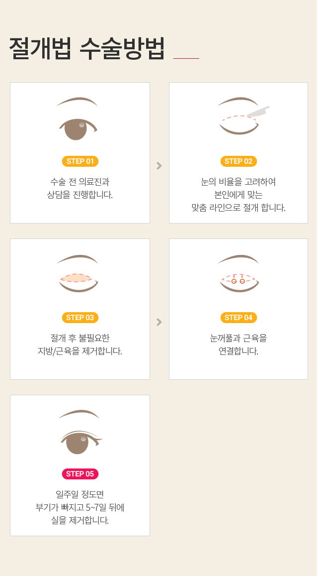 �ֲ�Ǯ����