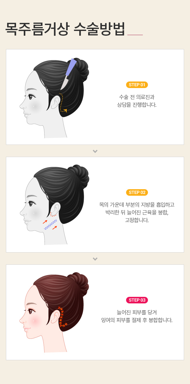 ���ָ��Ż�