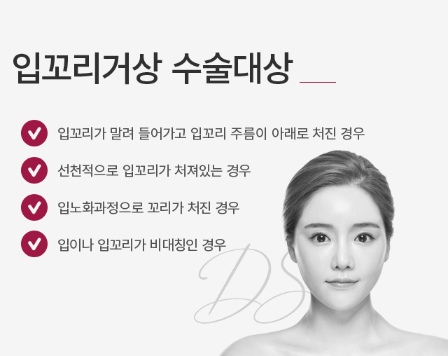 �Բ����Ż�