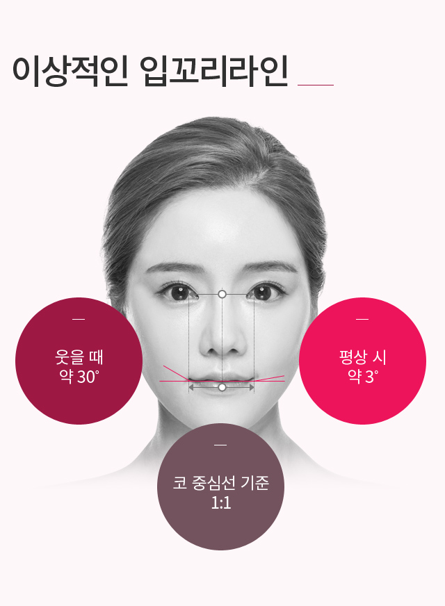 �Բ����Ż�