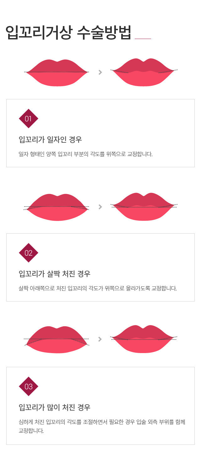 �Բ����Ż�